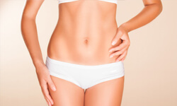 Picture of a trim woman showing her tummy tuck in Guadalajara, Mexico.