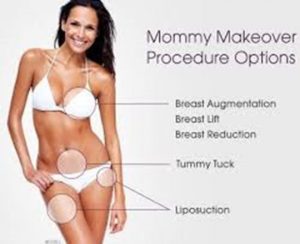 Picture of a woman showing options for various Mommy Makeover procedures in Costa Rica.