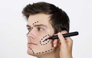 Picture of a man with lines drawn on his face depicting possible areas of facial procedures available in Costa Rica.