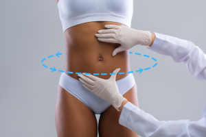 Picture of an Amazing 360 degree liposuction procedure in beautiful Costa Rica